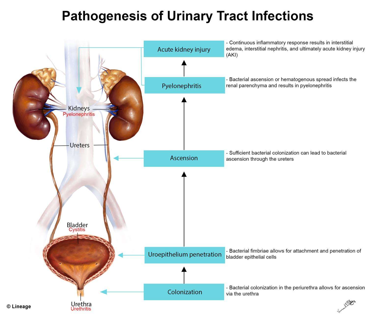 Does Urinary Tract Infection Cause Blood In Urine