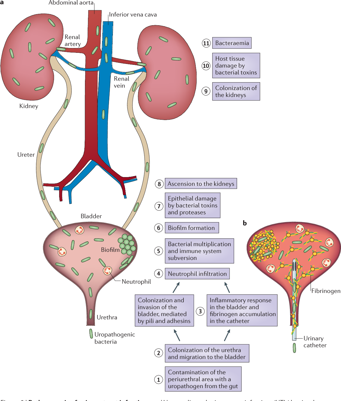 Figure 2 from Urinary tract infections: epidemiology ...