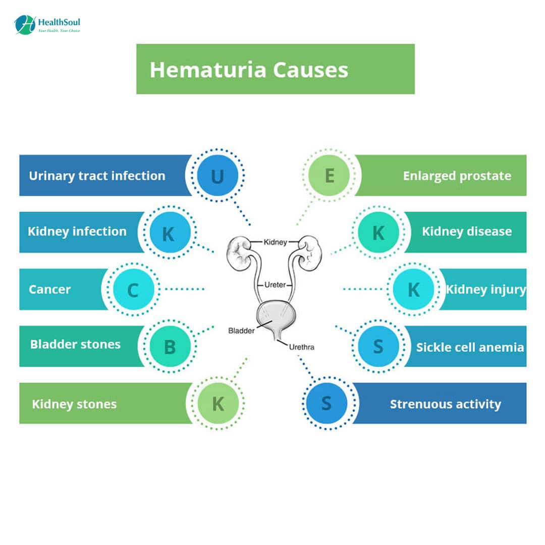 Hematuria or Blood In The Urine: Causes, Diagnosis and Treatment ...