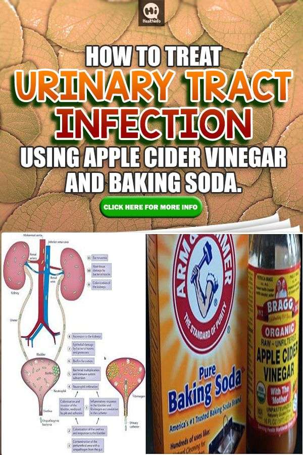 HOW TO TREAT URINARY TRACT INFECTION USING APPLE CIDER ...