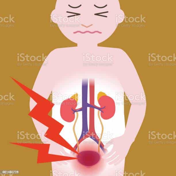 Inflammation Of The Bladder Human Urinary Organs Heart Kidney Bladder ...