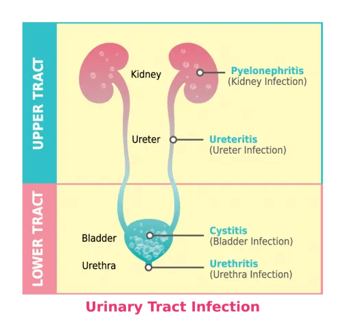 Lower Urinary Tract Symptoms / PPT