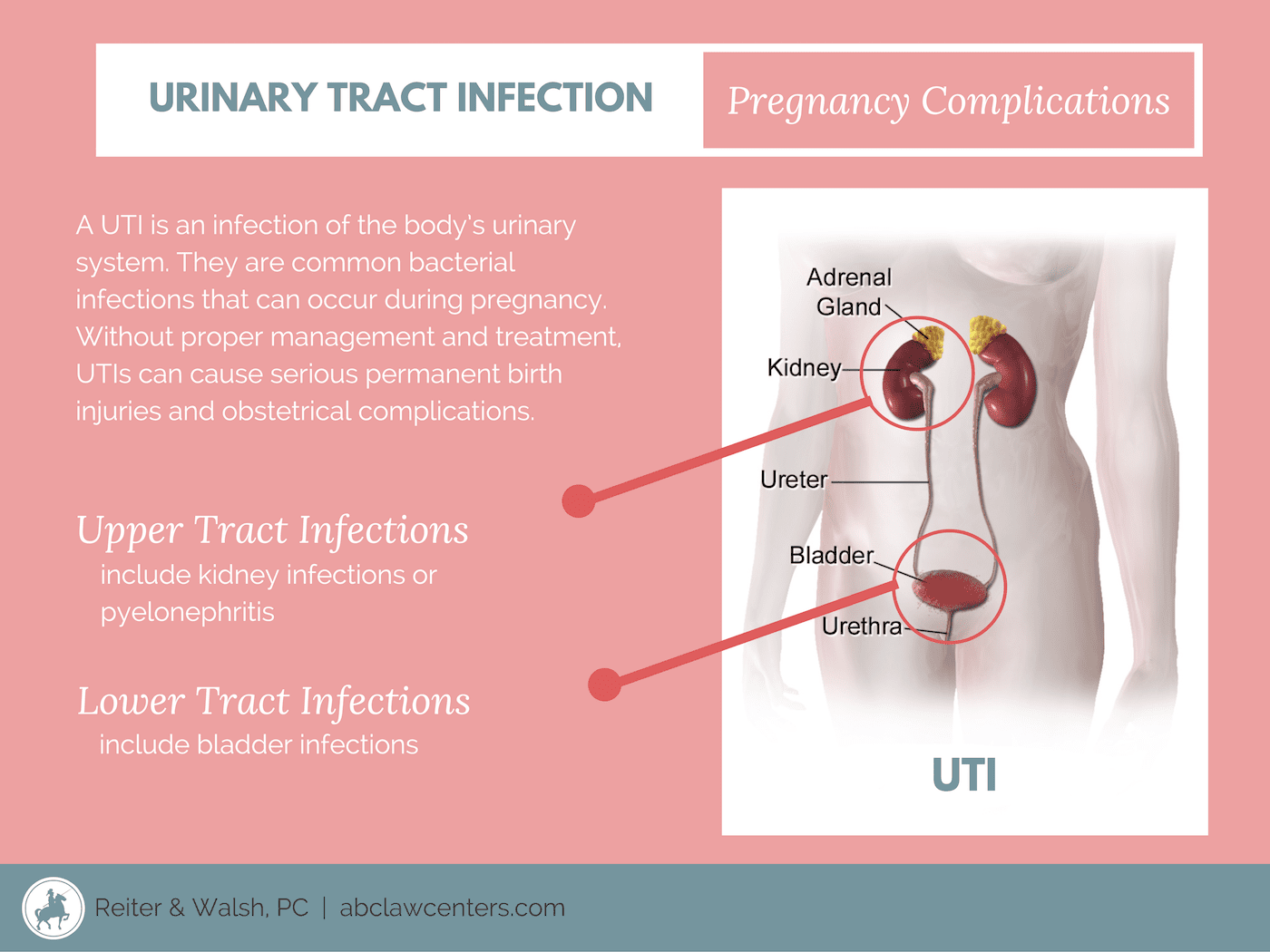 Prevention of Urinary Tract Infections (UTIs) In Pregnancy