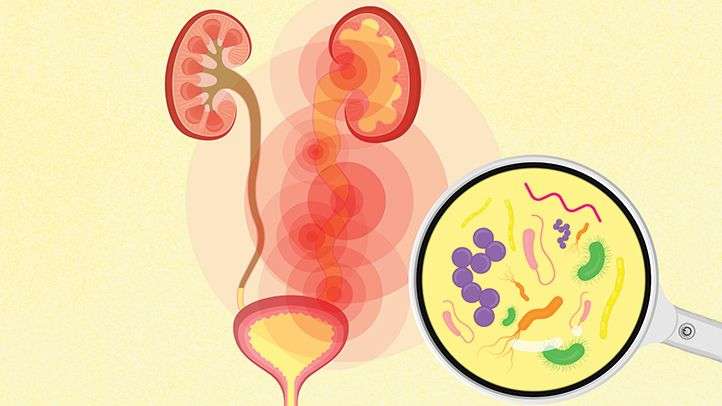 Urinary Tract Infections or UTIs: What to Know About ...