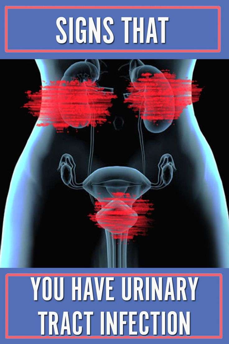 Urinary Tract Infections (UTIs) in Women