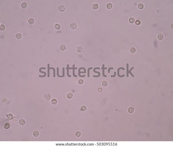 White Blood Cells Urinary Tract Infections Stock Photo (Edit Now) 503095516